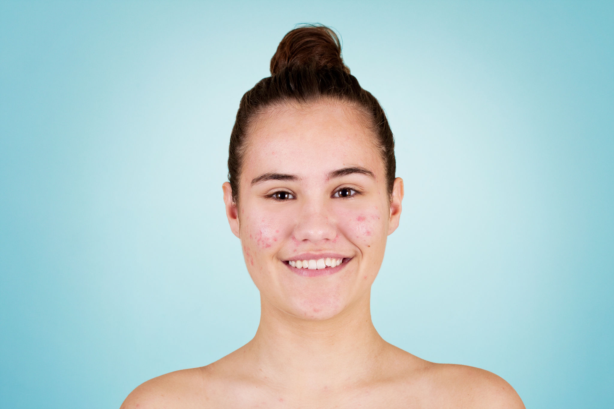 Before Photoshop retouching